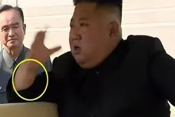 آثار عمل جراحی بر روی دست رهبر کره شمالی + عکس