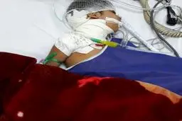 حمله سگ ولگرد به یک دختر بچه +عکس