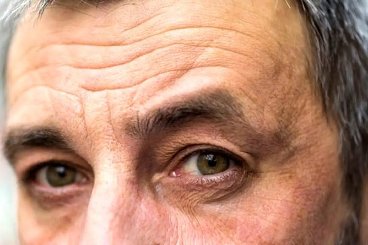 11 عادت روزمره که باعث ایجاد چین و چروک می شود