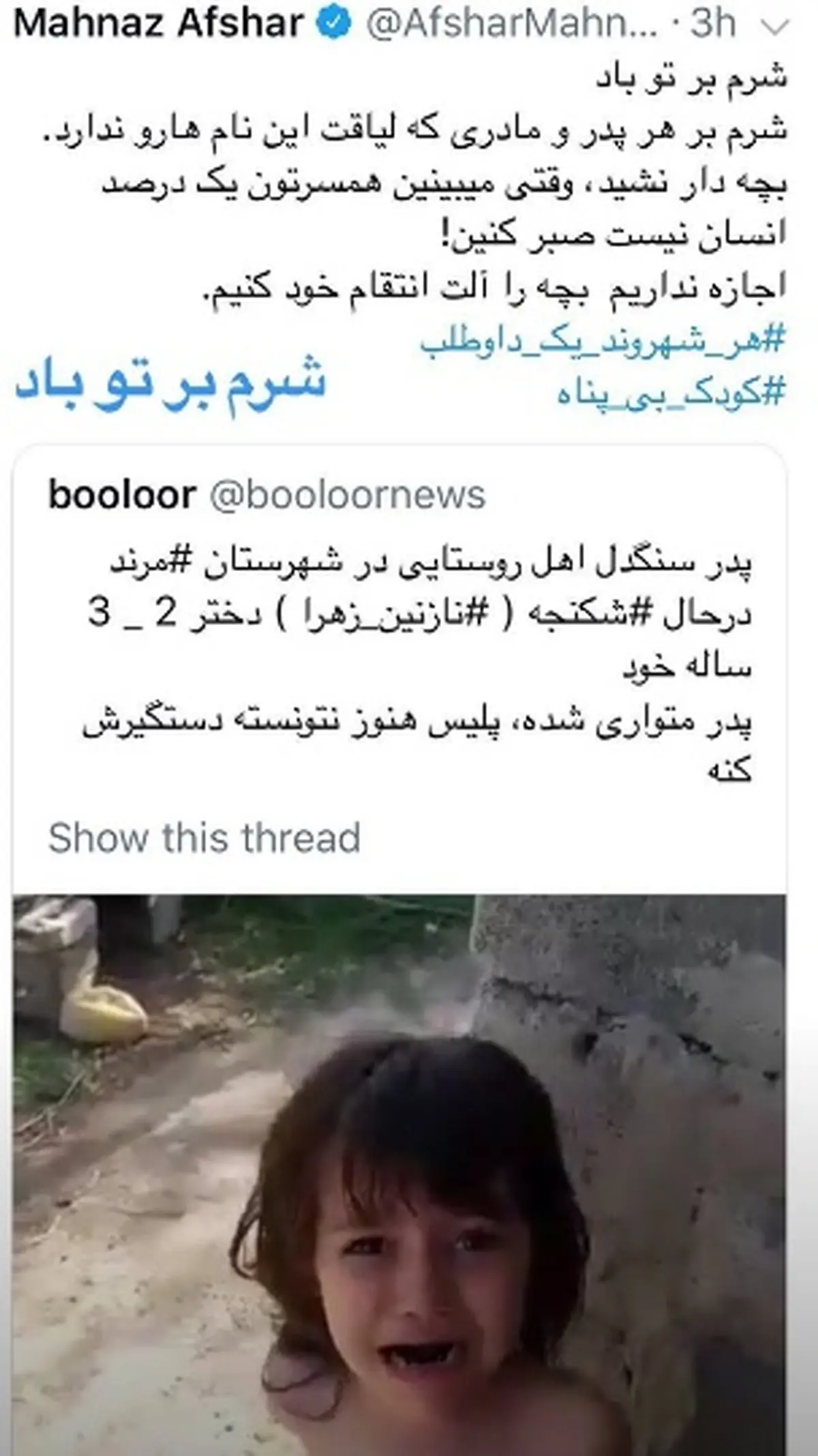 واکنش تند مهناز افشار به شکنجه دختر 3ساله مرندی توسط پدرش+ عکس