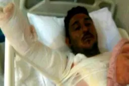 استعفای شهردار خرمشهر به دلیل خودسوزی یک معترض