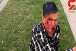 حمله نژادپرستانه با آجر به پیرمرد ۹۲ ساله در لس آنجلس + عکس