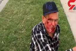 حمله نژادپرستانه با آجر به پیرمرد ۹۲ ساله در لس آنجلس + عکس