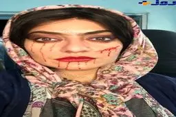 عکس وحشتناک از مهناز افشار