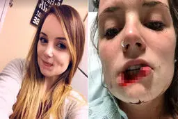 پسر بی شرم دختر زیبا را در خیابان خونین و مالین کرد! + عکس 16+