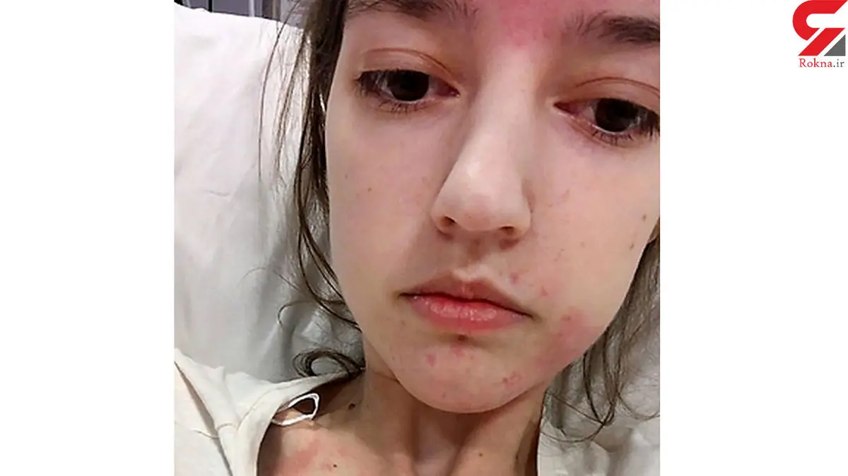 این دختر 20 ساله با قلب غذا می خورد + عکس