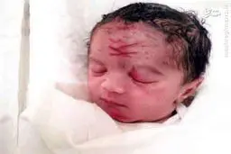 اشتباه وحشتناک پزشک هنگام سزارین/عکس