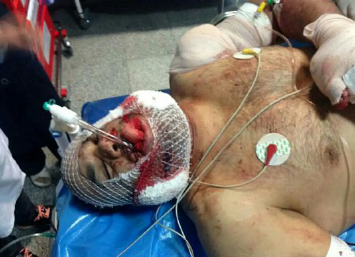 ملی‌پوش کشتی در نخستین لحظات پس از تیراندازی + عکس