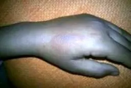 دستگیری معلمی که دست دانش‌آموزان را با قاشق داغ می‌سوزاند