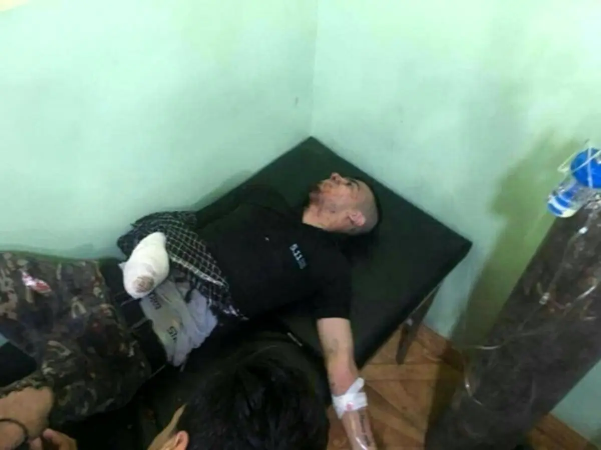 زخمی شدن نماینده ترکمن پارلمان عراق و فرزندش در کرکوک/عکس