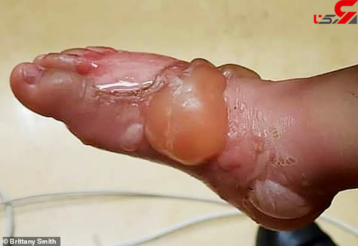 کباب شدن کودک 2 ساله توسط مادربزرگ بی رحم+ تصاویر تکاندهنده