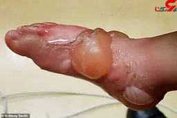 کباب شدن کودک 2 ساله توسط مادربزرگ بی رحم+ تصاویر تکاندهنده