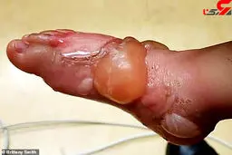 کباب شدن کودک 2 ساله توسط مادربزرگ بی رحم+ تصاویر تکاندهنده