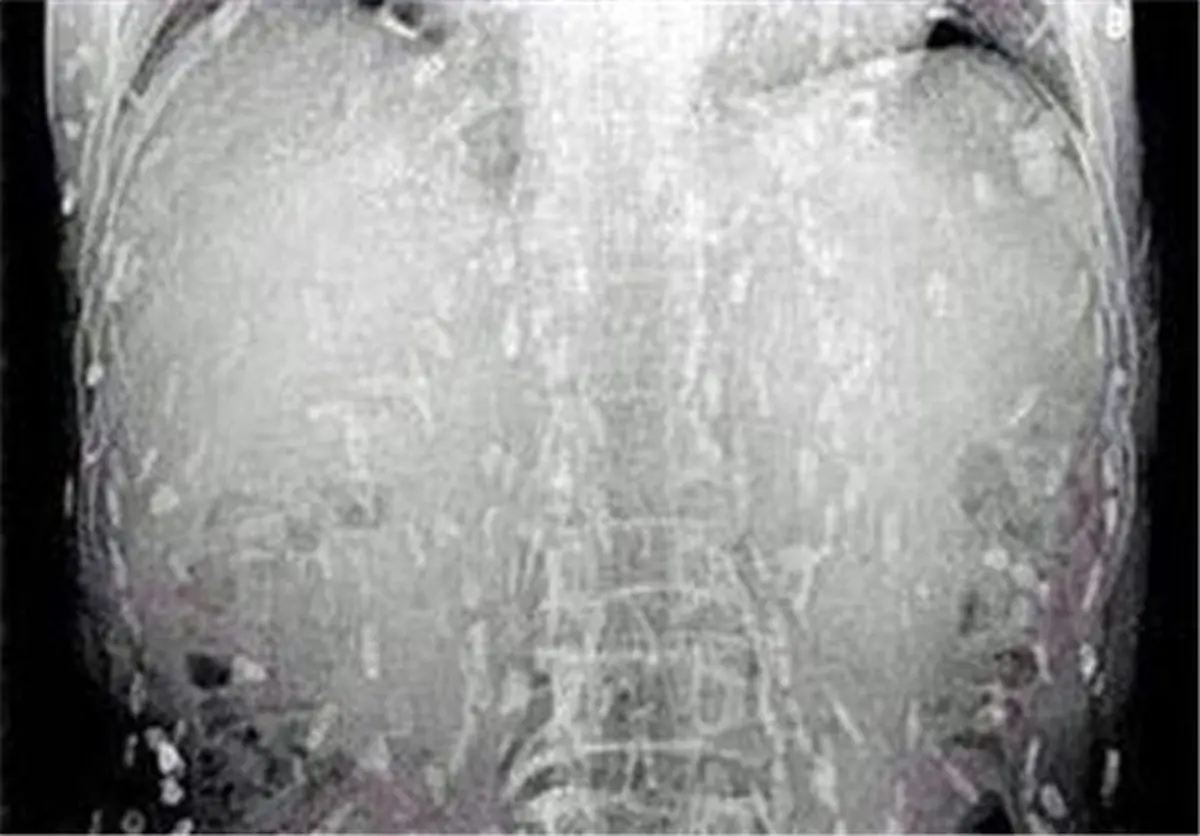 عاقبت خوردن سوشی/تصاویر