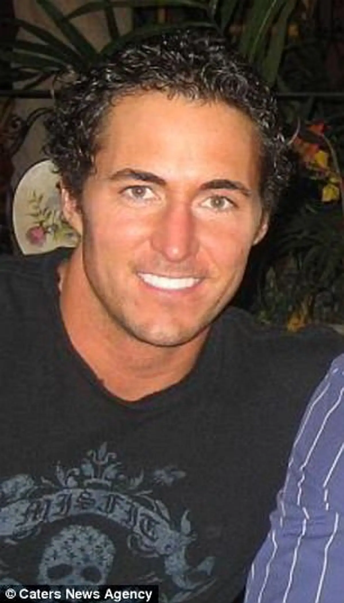 توموري که صورت مرد جوان را به نابودي کشاند+عکس