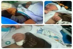 شکسته شدن بازوی نوزاد اصفهانی در حین زایمان/ عکس