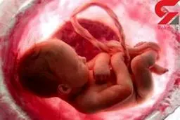 خدیجه قاتل جنین های زنان جوان بود