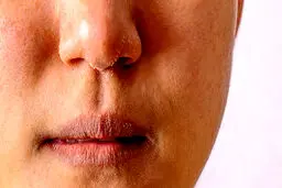 روش‌های درمان خشکی پوست در پاییز