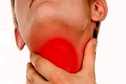 چرک گلو باعث بروز کرونا می‌شود؟