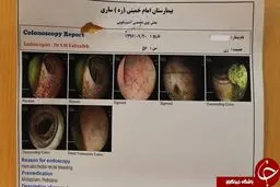 خارج کردن باند استریل از بدن یک زن 56 ساله!+ تصاویر