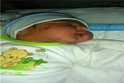 تکرار یک حادثه پزشکی دلخراش+عکس