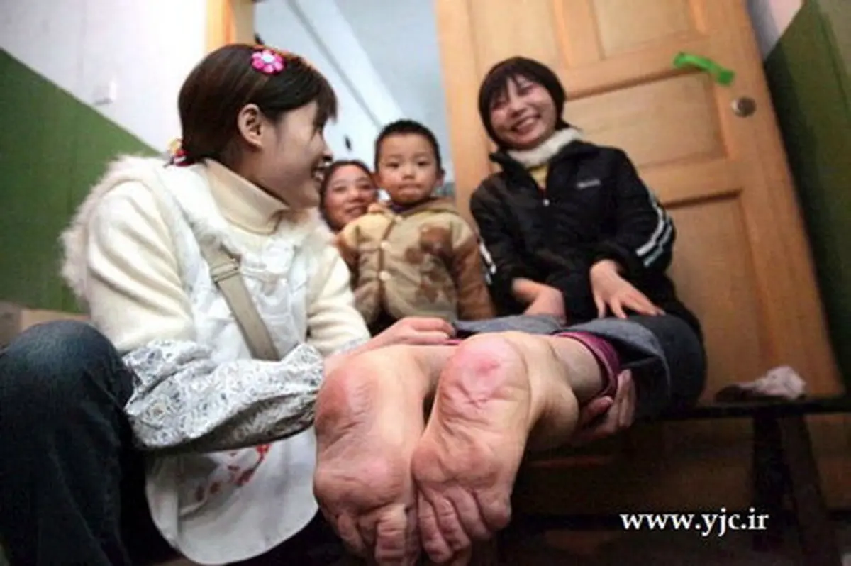 پاهای این زن، برعکس است /عکس