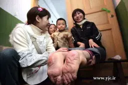 پاهای این زن، برعکس است /عکس