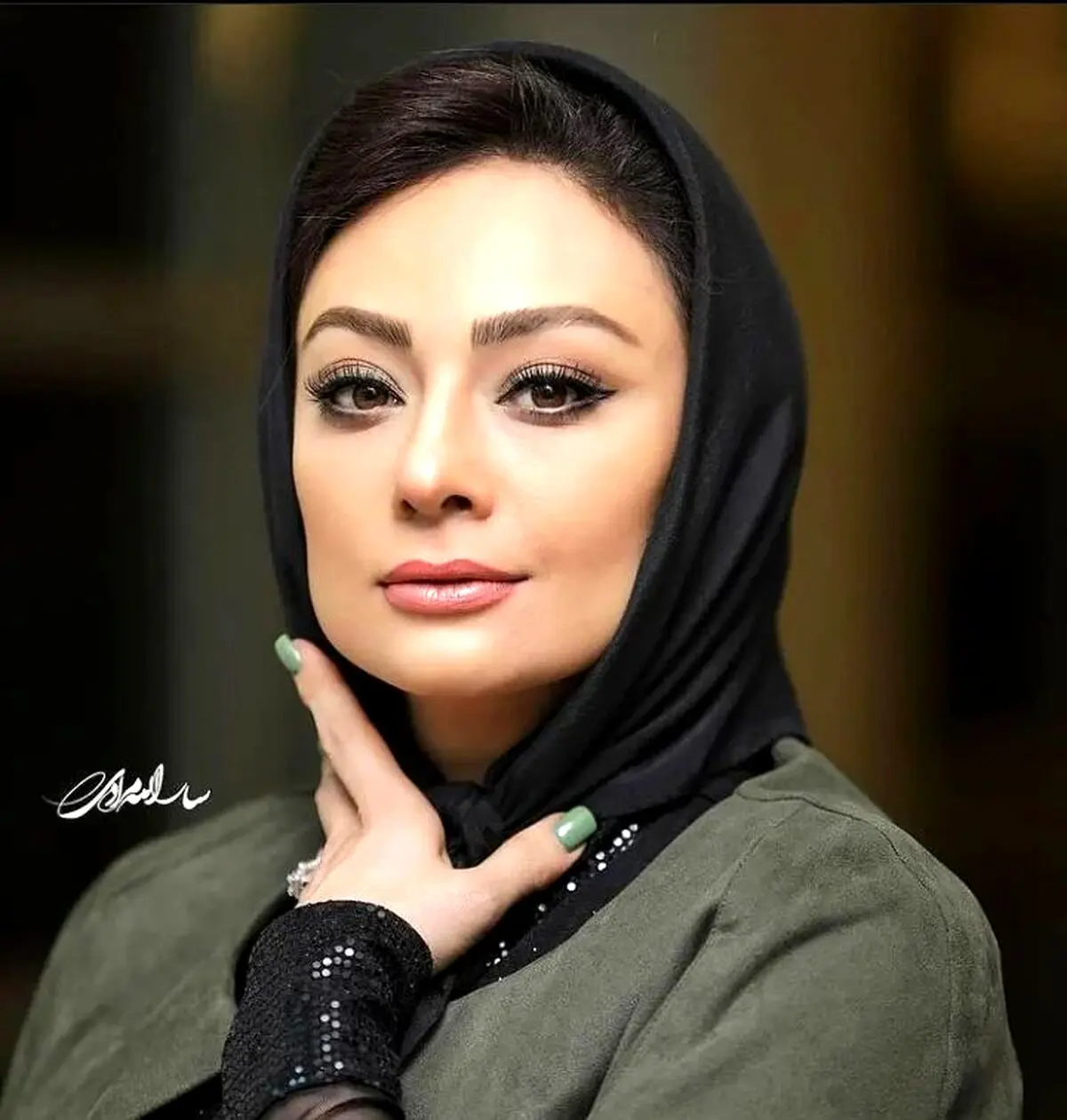 عکس عجیب یکتا ناصر همه را شوکه کرد | یکتا ناصر بعد از عمل جراحی وحشتناک شد