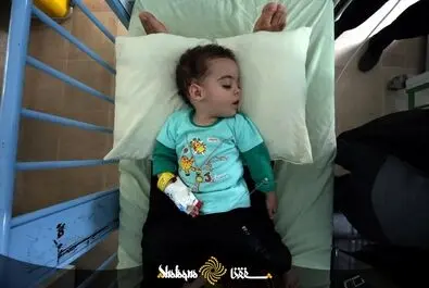 امیکرون در کودکان