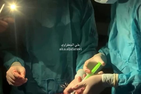 ببینید عمل جراحی خطرناک با نور موبایل در غزه