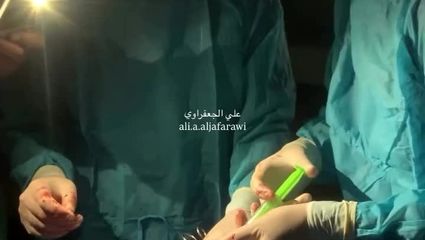 ببینید عمل جراحی خطرناک با نور موبایل در غزه