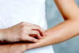 خارش پوست یعنی به این بیماری مبتلا شده اید!