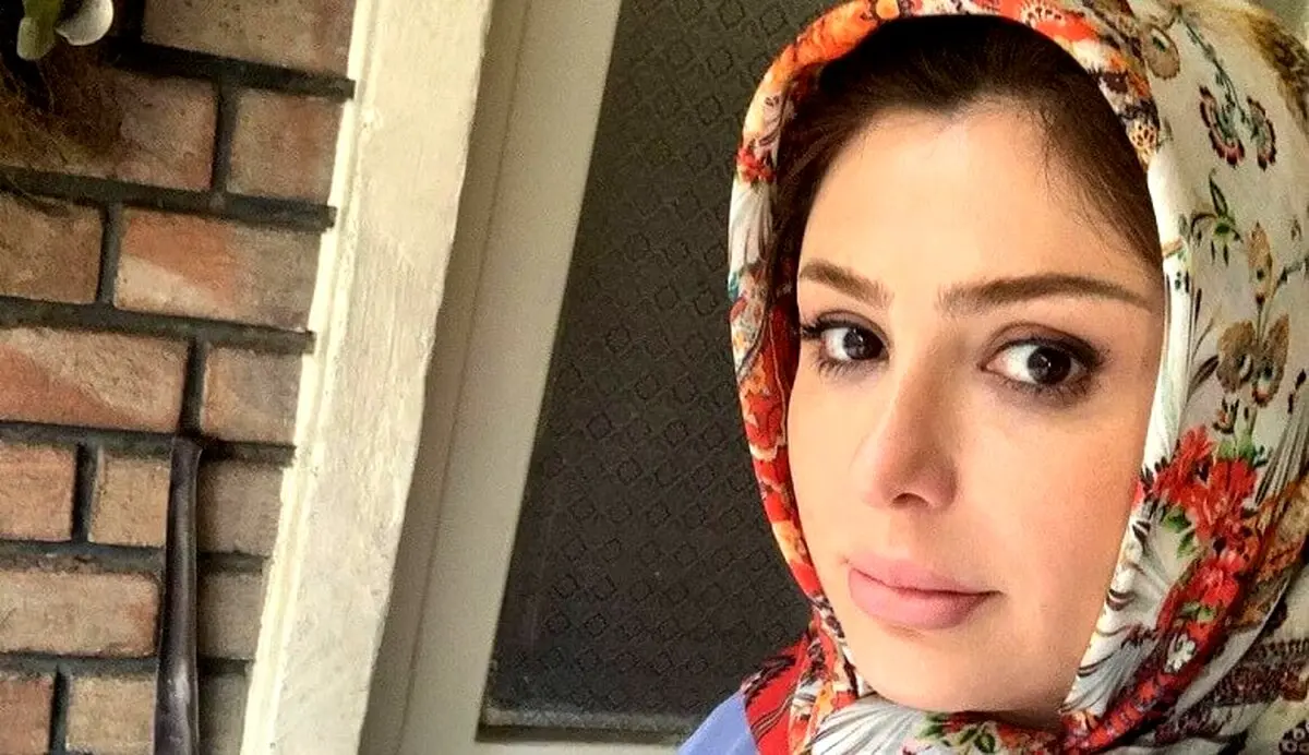 صورت خون آلود نیوشا ضیغمی