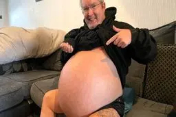 ماجرای مردی با کلیه های ۴۰ کیلویی که رکورددار جهان شده