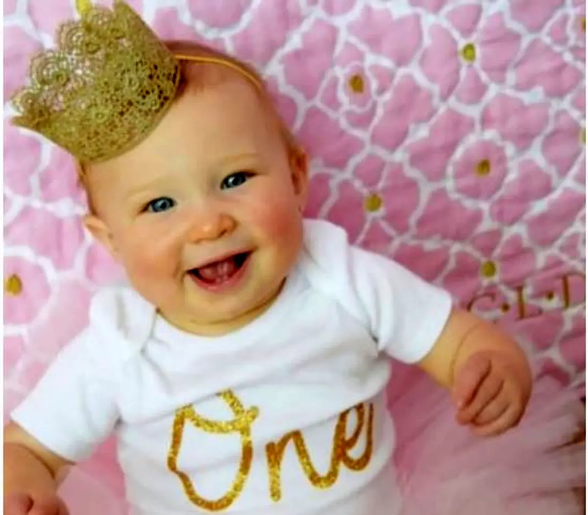 موی نوزادان حاوی مقادیری طلا است