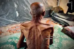 تصاویر هولناک از گرسنگی موذن مسجد غزه