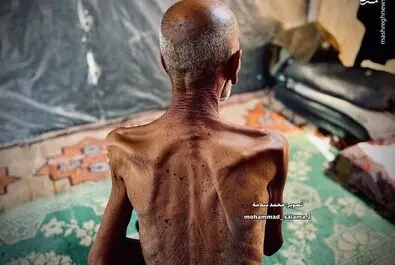 گرسنگی موذن