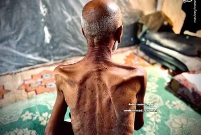 گرسنگی موذن