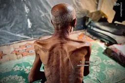تصاویر هولناک از گرسنگی موذن مسجد غزه
