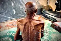 تصاویر هولناک از گرسنگی موذن مسجد غزه