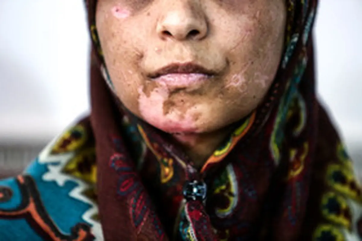 بعد از 21 روز شکنجه/ اعظم زنده است...