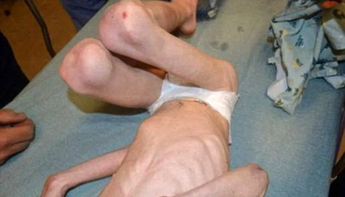 شکنجه کودک 5ساله توسط نامادری+تصاویر