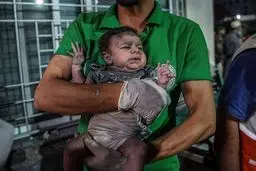 مقام فلسطینی: نیازمندی مجروحان غزه به ۵۰۰ هزار عمل جراحی