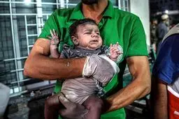 مقام فلسطینی: نیازمندی مجروحان غزه به ۵۰۰ هزار عمل جراحی