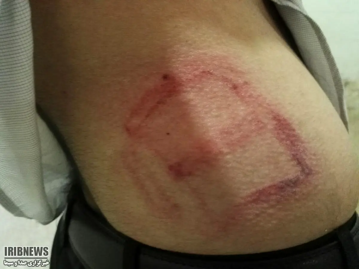 ضرب و شتم معلم و سرایدار یاسوجی در مدرسه +عکس