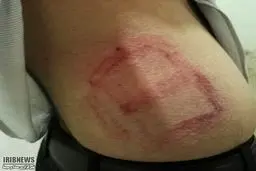 ضرب و شتم معلم و سرایدار یاسوجی در مدرسه +عکس