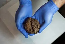 45 مغز انسان در یک گور دسته جمعی