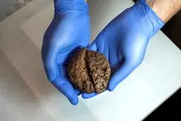 45 مغز انسان در یک گور دسته جمعی
