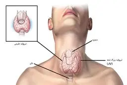 آزمایش تیروئید در منزل با آزمایش آنلاین