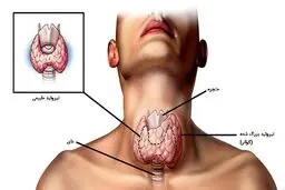 آزمایش تیروئید در منزل با آزمایش آنلاین